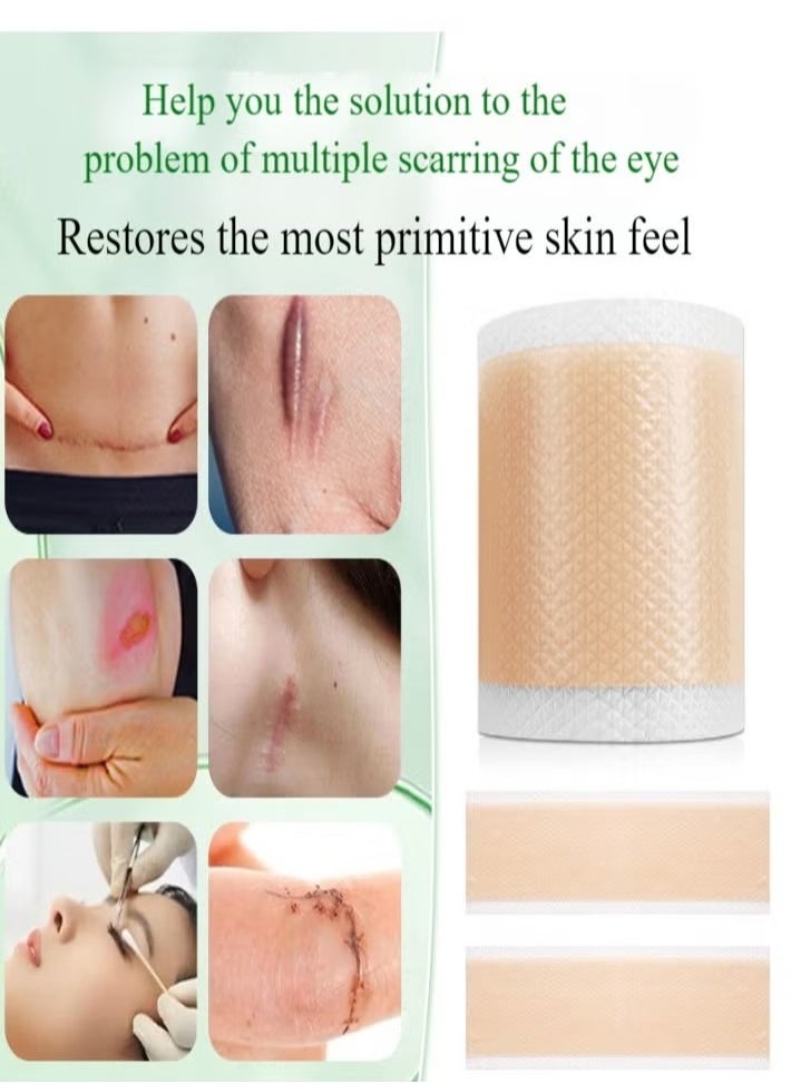 Generic Silicone Scar Tape, Medical Silicone Scar Removal Sheet, Stretch Mark Treatment Waterproof Silicone Scar Sheet, Fade Scar Effective Cosmetic Scar Removal Gel Painless Tape Roll for Cesarean Section, Burn Scars and Other Scars (4cm x 1.5m)  - Image 2