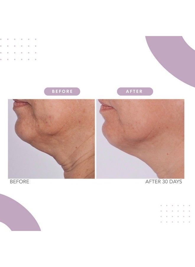 سيريوس سكين كير مجموعة Serious Skincare Reverse Lift Trio Skin Firming Set - شد ورفع ونحت الوجه والذقن والرقبة - ببتيدات - كولاجين مائي - (عبوة من 3 قطع)  - Image 3