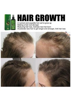 Jaysuing Hair Growth Serum Hair Lotion ,Hair Loss Treatments, Aids against Hair-thining, Hair Regrowth Treatment  - Image 3