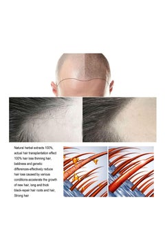 Jaysuing Hair Growth Serum Hair Lotion ,Hair Loss Treatments, Aids against Hair-thining, Hair Regrowth Treatment  - Image 4