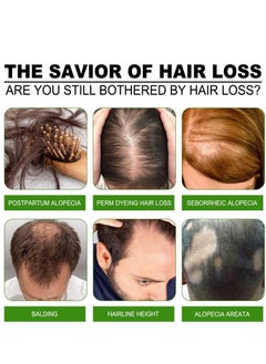 Jaysuing Hair Growth Serum Hair Lotion ,Hair Loss Treatments, Aids against Hair-thining, Hair Regrowth Treatment  - Image 5