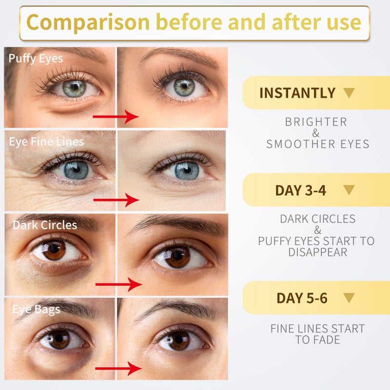 NAZANO 24K Gold Under Eye Patches - 60 Pack for Puffy Eyes, Dark Circles, Bags & Wrinkles with Collagen & Hyaluronic Acid - Image 3