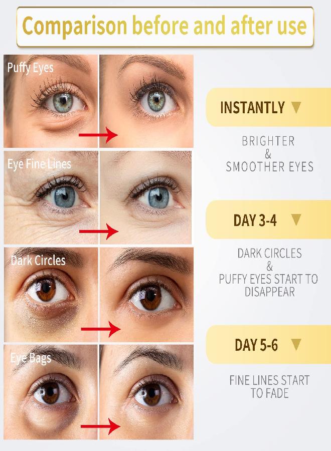 NAZANO NAZANO Under Eye Patches - 30 Pairs - 24K Gold Eye Mask- Puffy Eyes & Dark Circles Treatments,Reduce Under Eye Bags and Smooth Wrinkles,Eye Skin Care Pads With Collagen  - Image 2