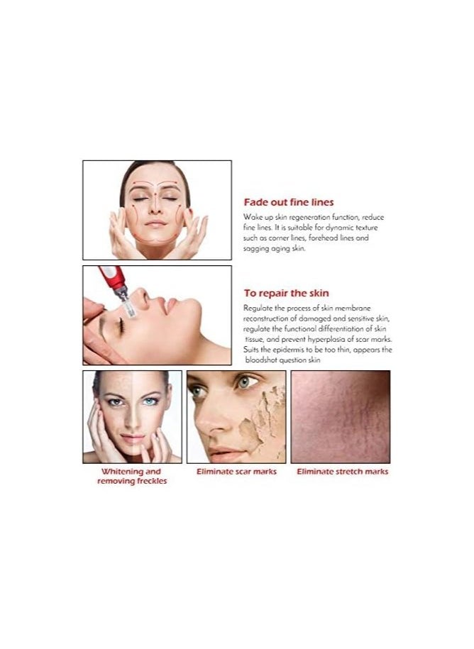 ماي إم - جهاز My M Derma Pen - Image 1