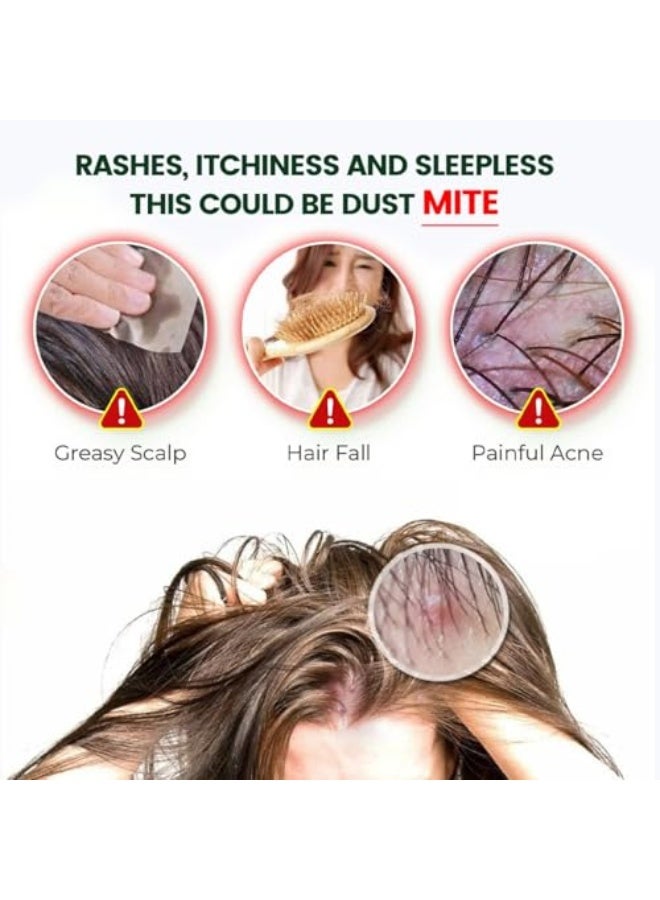 Sumifun Mite Removal Cream, 30g - Effective Scalp Itch Relief and Mite Treatment - Soothes and Reduces Scalp Irritation - Massage Cream for Scalp Care - Relieves Itching and Promotes Healthy Hair - Image 4