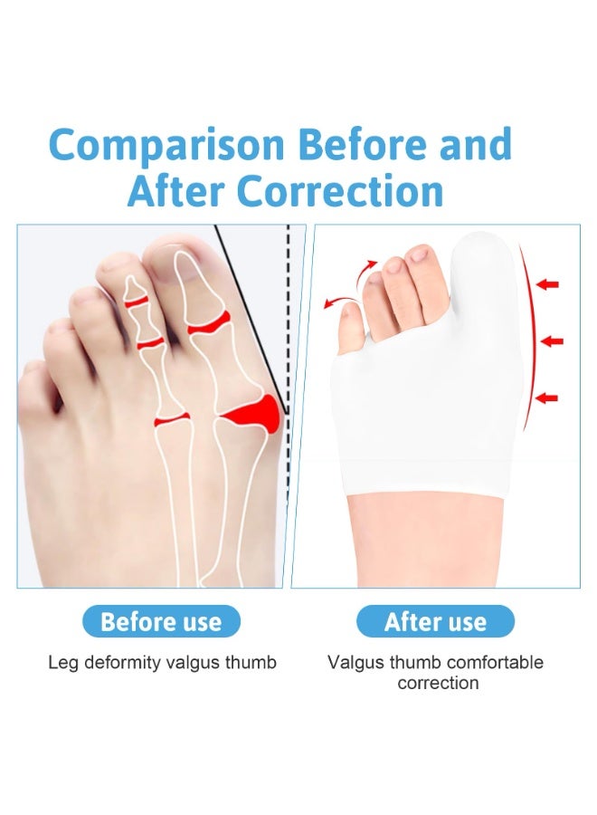 2 Pieces Large White Reusable Soft Gel Toe Protector Set, Big Toe Caps & Metatarsal Foot Sleeves, Comfort Bunion Pain Relief Cushions For Men Women, Anti-Friction Pads Prevent Corns Blisters Calluses Ingrown Toenails - Image 2