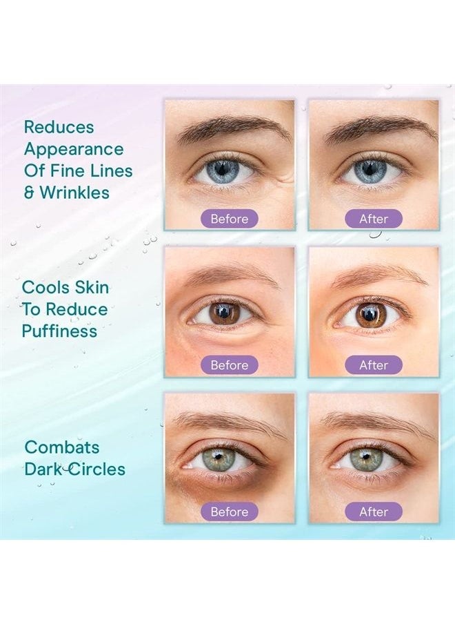 Baebody - Critically Acclaimed Eye Gel Balm Treatment Products, Under Eye Cream for Dark Circles and Puffiness, Eye Bags Treatment Women & Men, Peptide & Aloe 1.7 Fl Oz - Image 1