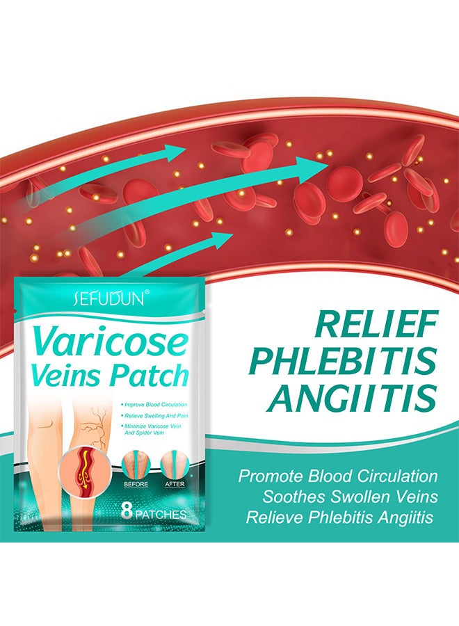 Sefudun 16 PCS Varicose Veins Patch, Varicose Veins Treatment For Legs, Spider Varicose Vein, Strengthen Capillary Health and Improve Blood Circulation, Improves Blood Circulation, Relieves Leg Fatigue - Image 4