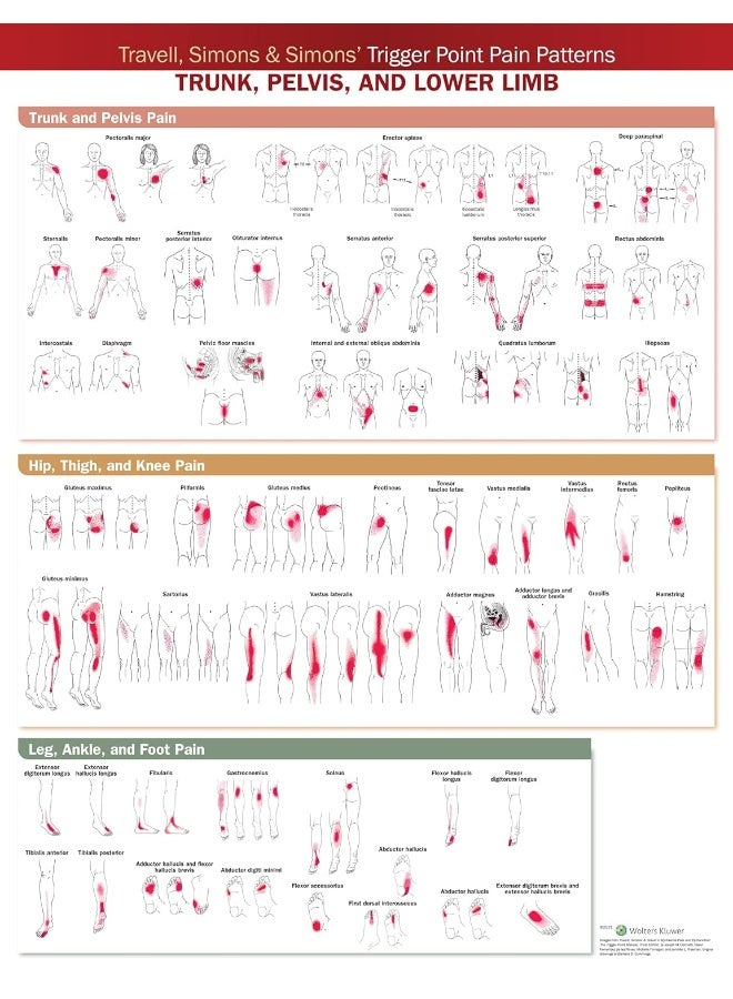 Travell, Simons & Simons’ Trigger Point Pain Patterns Wall Chart: Trunk, Pelvis, and Lower Limb 