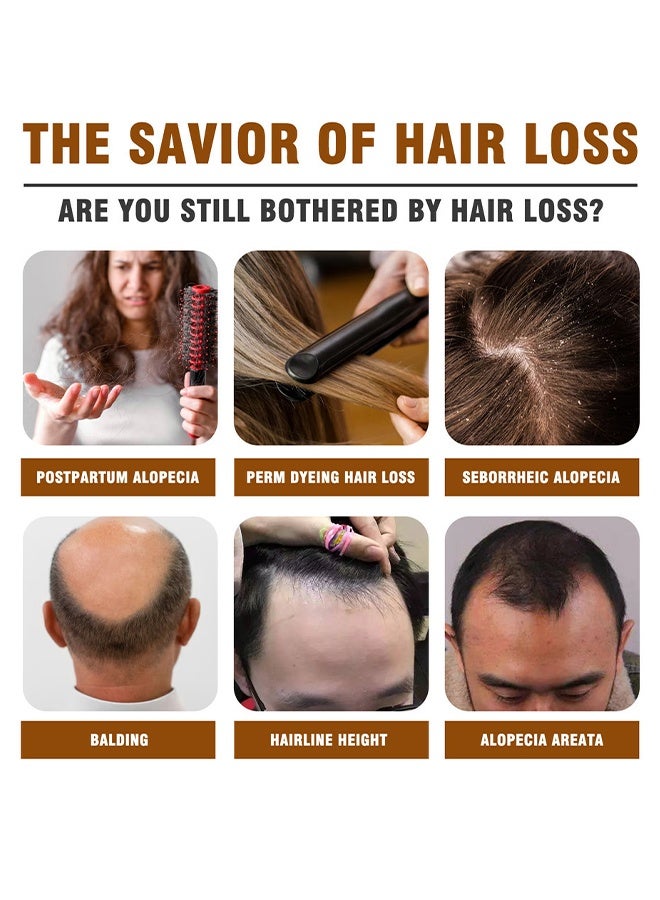 سوفازين سيروم بيوتين لنمو الشعر الفاخر، سيروم لتكثيف الشعر بزيت الخروع ومستخلص جذور الزنجبيل، سيروم لتكثيف الشعر وزيادة حجمه لتعزيز نمو الشعر، يقلل من تساقط الشعر 30 مل - Image 2