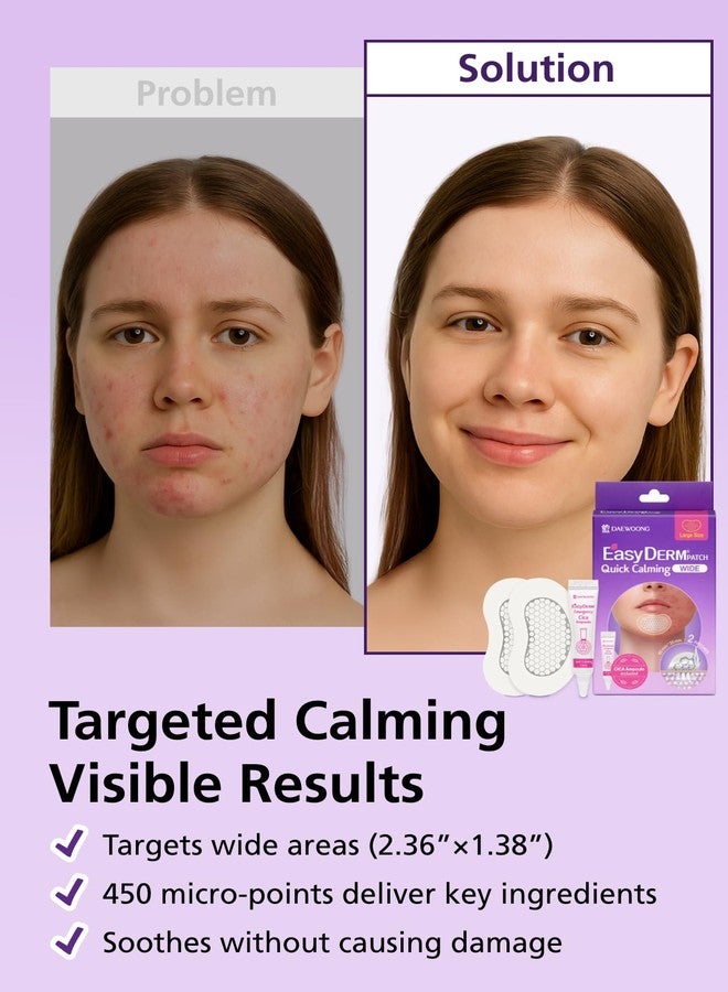 DWEasyDerm EasyDerm Quick Calming Magnesium Patches WIDE – 2 Large Face Acne Patches for Breakouts, TikTok Viral Microdot, With Bonus CICA Mini Ampoule, Summer and Travel Essentials - Image 3