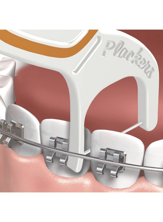 بلاكرز خيط تنظيف أسنان Orthopick غير منكه مصمم لتقويم الأسنان القابل للطي من Tuffloss سهل التخزين مع ختم Surezip عدد 36 - Image 5