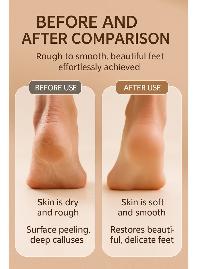 Portable Electric Foot Skin Remover – Easy-to-Use Pedicure Device for Rough and Dead Skin - Image 2