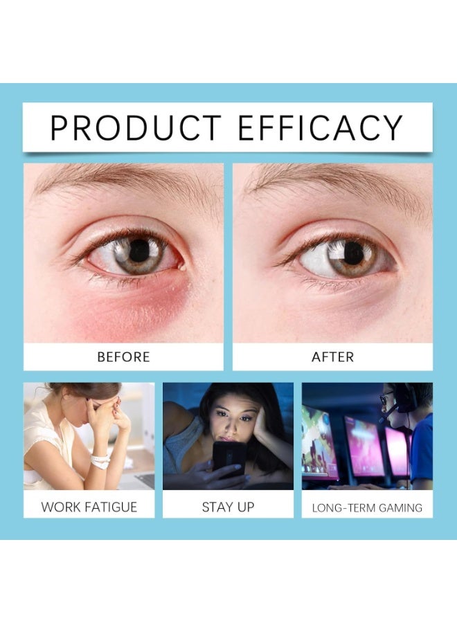ximonth Eye drops,soothing and lubricating eye drops,relieves dryness and fatigue of the eyes,enhances clarity of vision,10 packs are convenient and portable  - Image 2