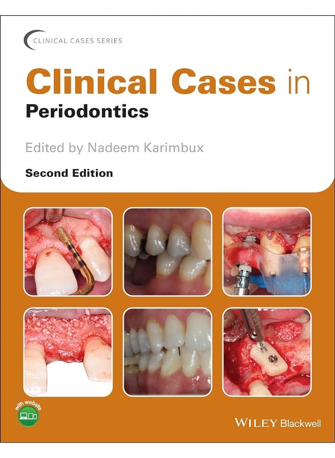 Clinical Cases in Periodontics - pzsku/Z3852DA0DF8B8EEFF69A1Z/45/_/1733824037/99661d94-5922-40e7-b5a5-c97e7f8e3aac