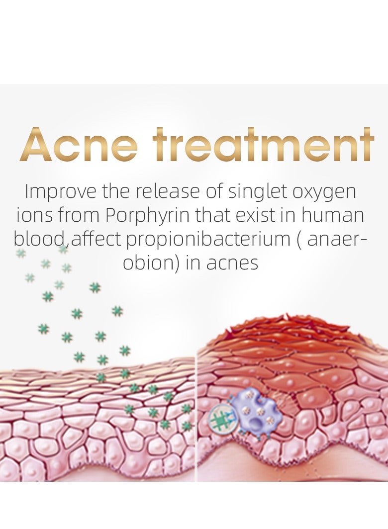 ديس جهاز إزالة الشعر بالليزر GP590 PLUS IPL مع وظيفة التبريد بالثلج، نظام إزالة الشعر بالليزر الدائم، أصلي وأصلي 100% - Image 5