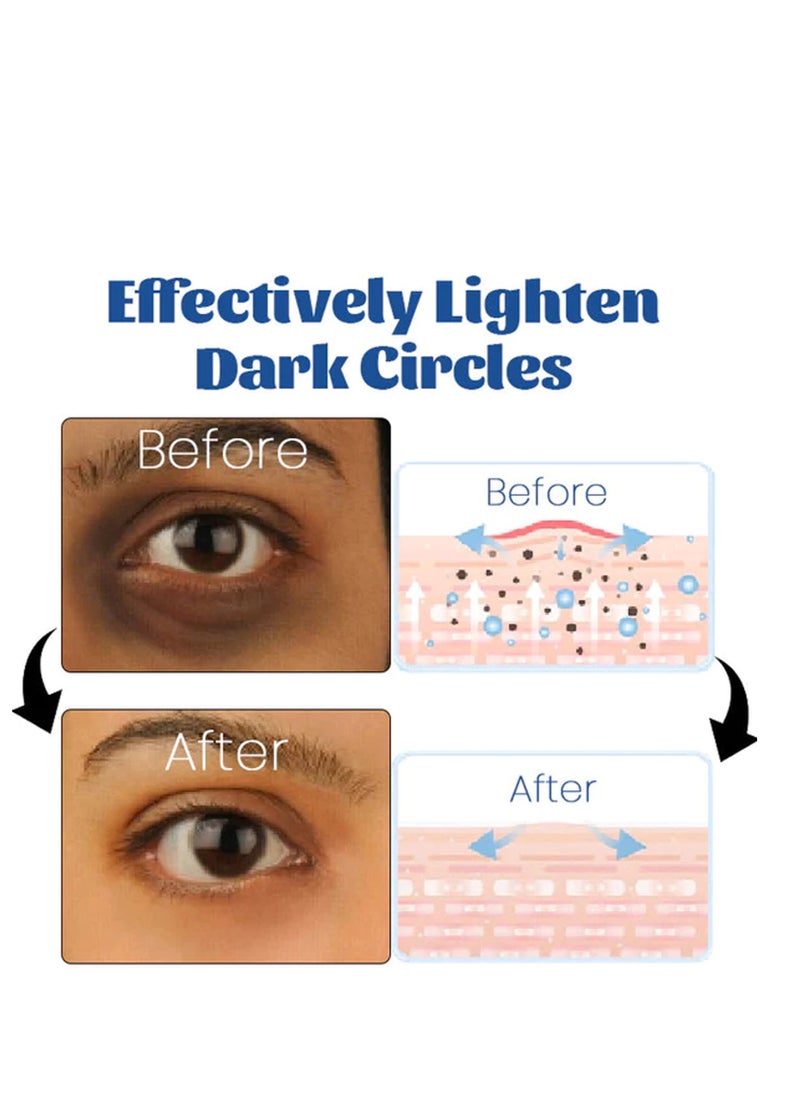 Retinol Eye Cream,Eye Care Cream,Anti-aging,Reduce Sebum Overflow, Dilute Epidermal Pigment,Smooth The Skin,Tighten The Skin,Increase Skin Elasticity, 15g