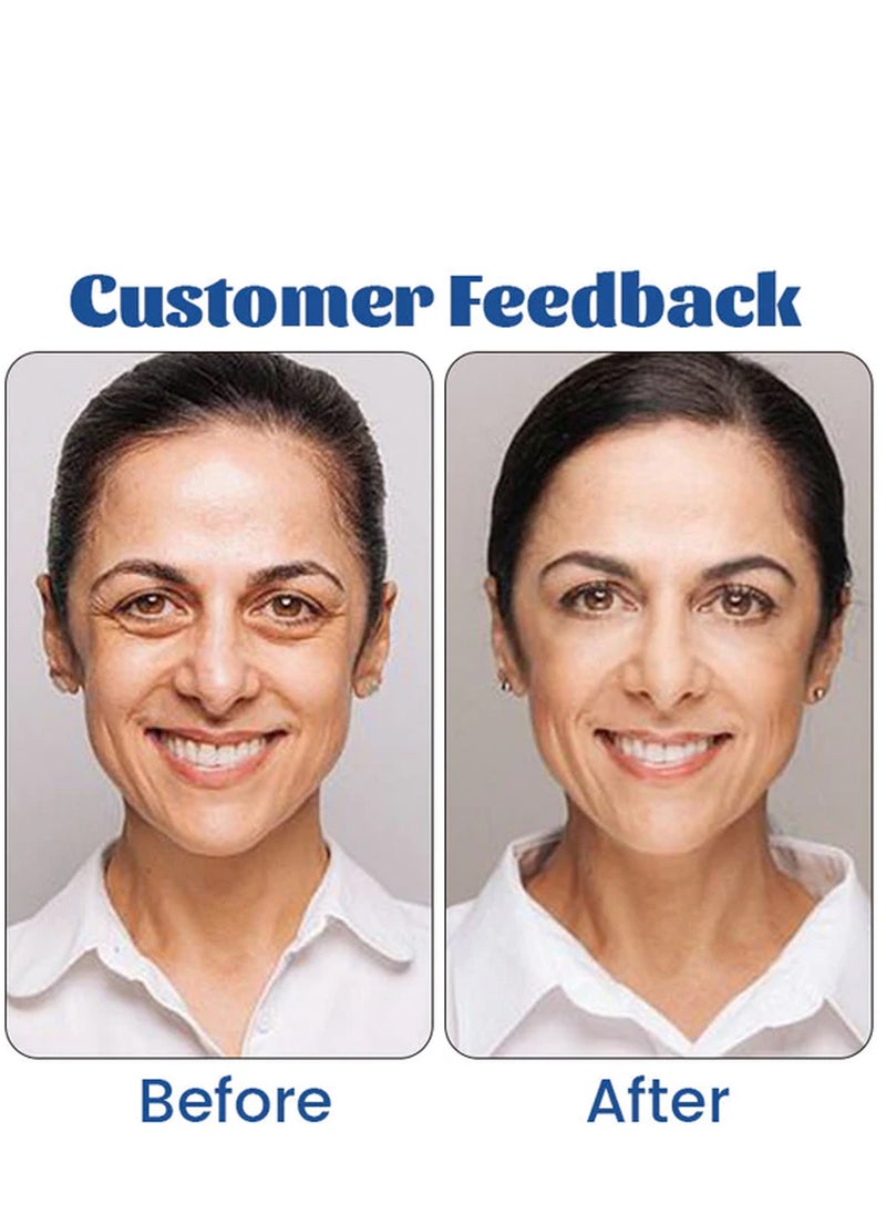 Retinol Eye Cream,Eye Care Cream,Anti-aging,Reduce Sebum Overflow, Dilute Epidermal Pigment,Smooth The Skin,Tighten The Skin,Increase Skin Elasticity, 15g
