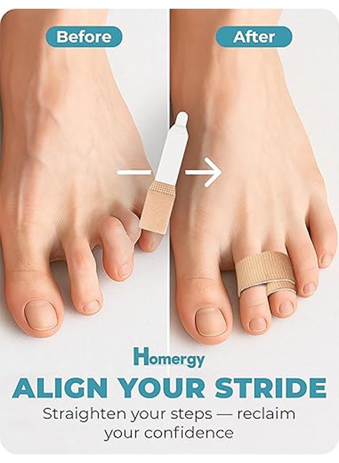 مجموعة من 4 قطع من مصحح أصابع القدم المطرقية للرجال والنساء، ضمادات وشريط لاصق لأصابع القدم المكسورة والملتوية والمتداخلة - جبائر قماشية ناعمة مزدوجة الطبقات لتخفيف الألم ومحاذاة الأصابع - Image 4