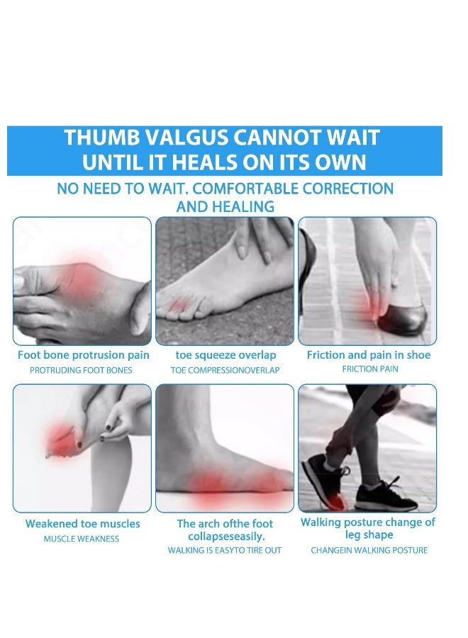 Bunion Corrector for Women and Men, 1 Pair Soft Slip Proofing Bunion Socks that Fit In Shoes, Big Toe Corrector, Silicone Toe Separators, Toe Spacers for Big Toe Pain Relief, Beige - Image 5