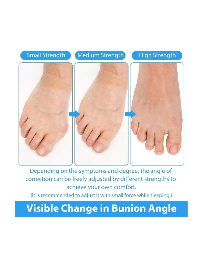 Bunion Corrector for Women and Men, 1 Pair Soft Slip Proofing Bunion Socks that Fit In Shoes, Big Toe Corrector, Silicone Toe Separators, Toe Spacers for Big Toe Pain Relief, Beige - Image 3