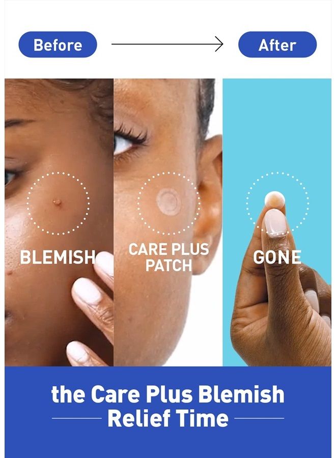 OLIVE YOUNG Care Plus Spot Pimple Patches 1Pack(102 Count) - Hydrocolloid bandages, Sticker pack for Acne, Blemishes, and Zits, (10mm*72ea+12mm*30ea)  - Image 2