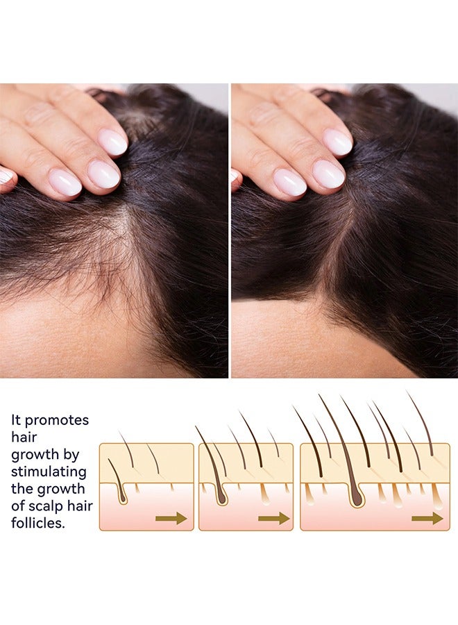 OUHOE Hair Growth Spray for Men & Women, Hair Growth Oil, Hair Enhance Serum, Stronger and Hair Thickening Spray - Image 5
