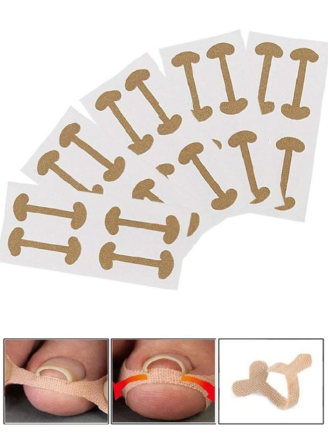 Ingrown Toenail Treatment Strips, 20 Pcs Toe Nail Correction Patch Elastic Patch Sticker Corrector Pedicure Tools Fingernail Toe Nail Care - Image 1