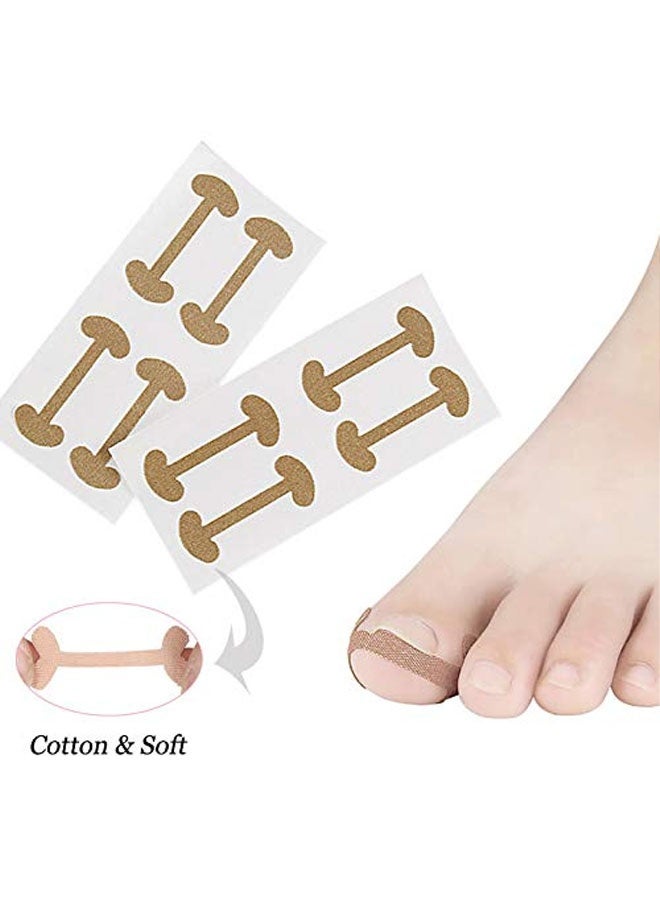 Ingrown Toenail Treatment Strips, 20 Pcs Toe Nail Correction Patch Elastic Patch Sticker Corrector Pedicure Tools Fingernail Toe Nail Care - Image 5