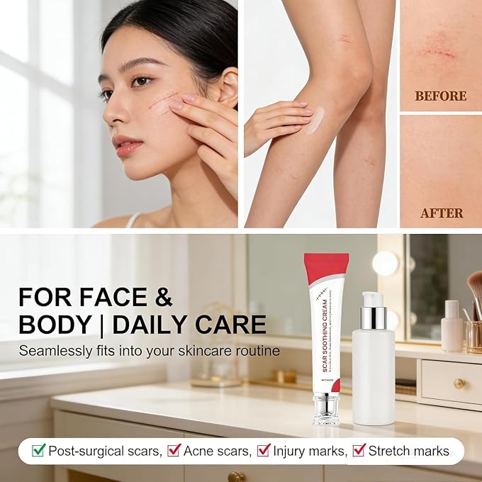YOOJ Scar Smoothing & Soothing Cream, Gentle Formula for Sensitive Skin, Improves Scar Appearance and Reduces Redness, Lightweight Non-Greasy Texture - Image 2