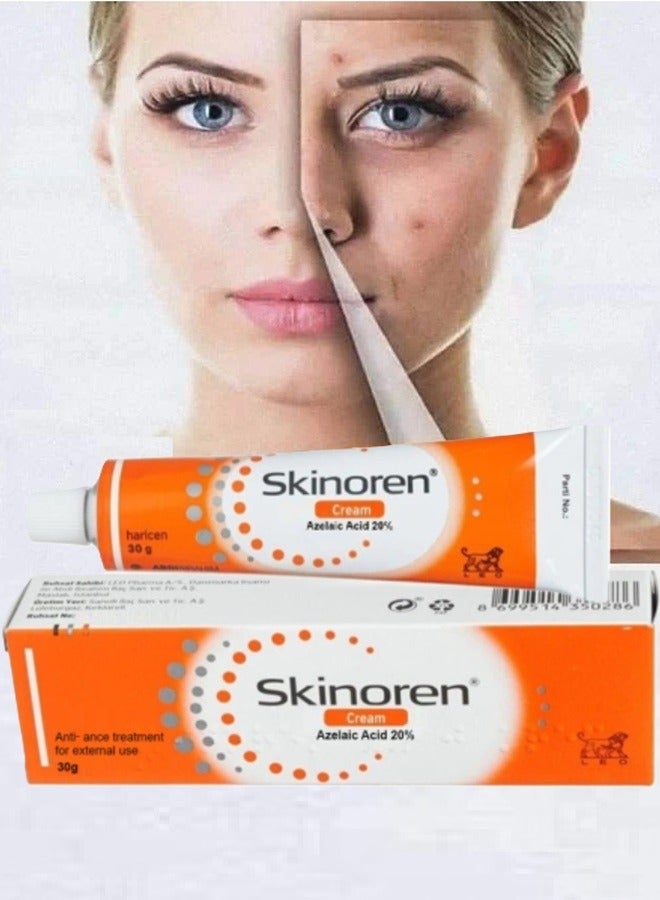 Skinoren Anti Acne Treatment Cream 30g - Image 3