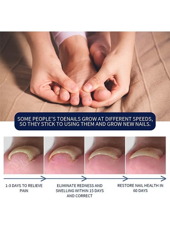 West&Month Removal Paronychia Oil- Ingrown Toenail Nail Repair Toenail Plus Anti Paronychia Relief Oil Nail Renewal Liquid for Damaged and Discoloration Nail Swelling and Pain removal Oil  - Image 3
