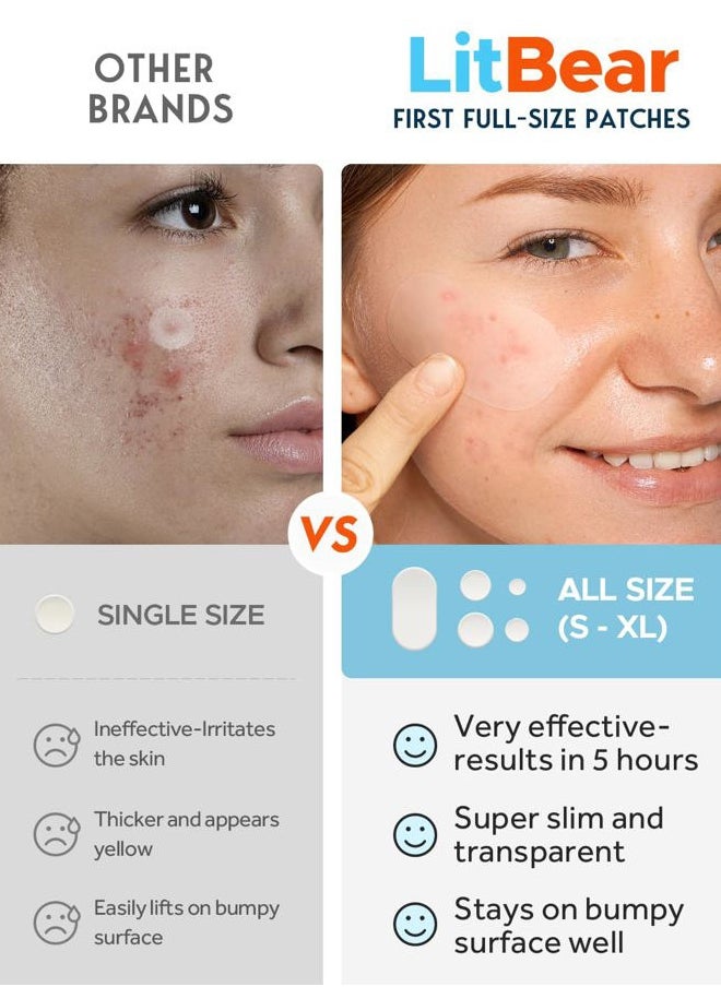 LitBear Large Acne Pimple Patches, 5 Sizes 80 Patches for Large Breakouts, Acne Patches for Face, Chin or Body, Acne Spot Patch with Tea Tree & Calendula Oil, Hydrocolloid Bandages for Acne Skin  - Image 3