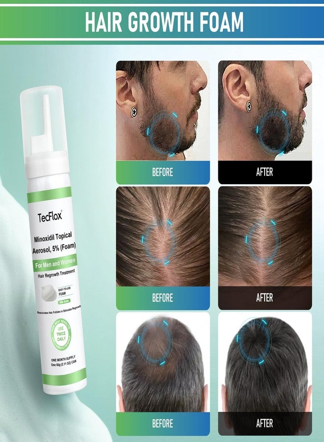 Tecflox Minoxidil Foam - 5% Minoxidil for Men and Women, Hair and Beard Growth with Biotin, Thicker Hair, Unscented, 3 x 2.11 Oz, 3-Month Supply, Hair Loss Treatment,Green - Image 4
