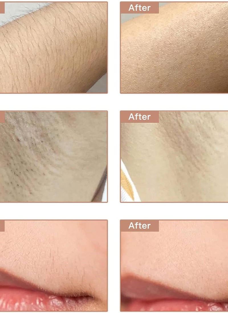 Generic - Prettywell IPL Hair Removal Device, Permanent Painless for Men with Ice Cooling Function, Updated to 999,900 Flashes, by Crave Beauty - Image 1