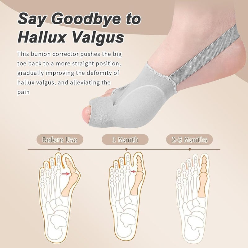 2 bunion aligners/splints/brackets, unisex, big toe aligners/separators, for relieving hallux valgus pain and correcting toe alignment, soft and breathable, available day and night, one size fits all - Image 2