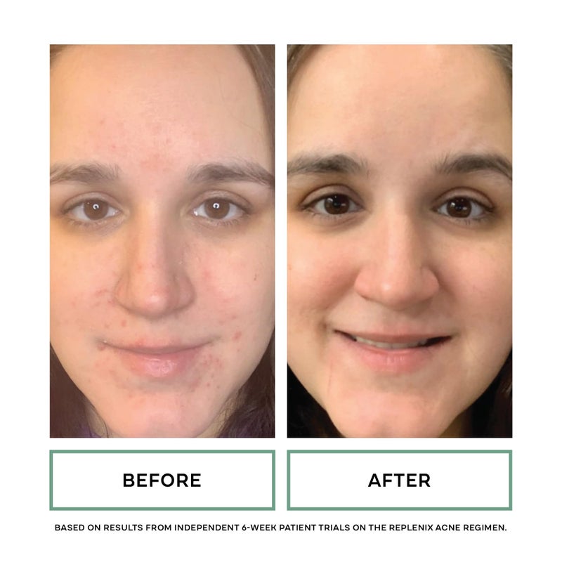 Replenix Green Tea Gentle Soothing Facial Cleanser, Medical-Grade Sensitive Skin Face Wash, Now with New & Improved Packaging (6.7 fl. oz) - Image 4