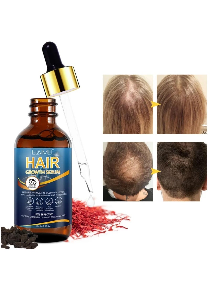 Elaimei - 60ml Hair Growth Serum Natural Hair Regrowth Serum Essence 5% Biotin Minoxidil Hair Serum for Hair Loss Treatment Stronger Thicker Longer Hair Beard Growth Oil Herbal Hair Growth Oil - Image 1