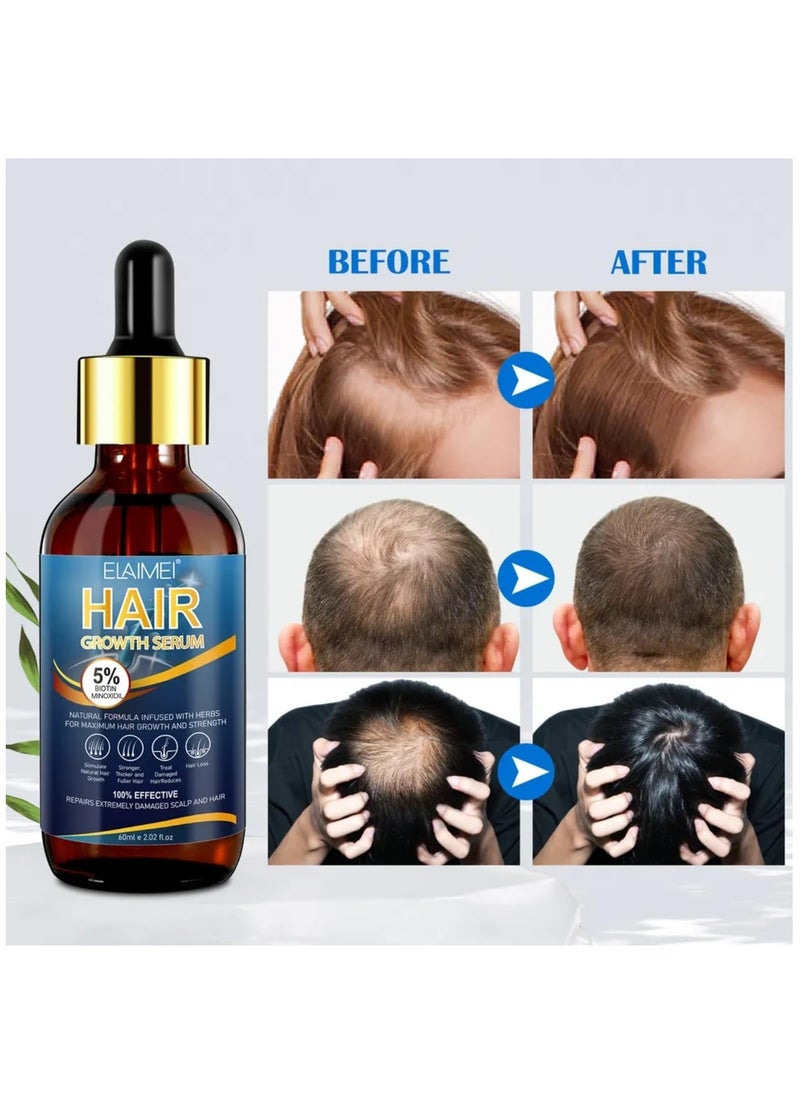 Elaimei - 60ml Hair Growth Serum Natural Hair Regrowth Serum Essence 5% Biotin Minoxidil Hair Serum for Hair Loss Treatment Stronger Thicker Longer Hair Beard Growth Oil Herbal Hair Growth Oil - Image 1
