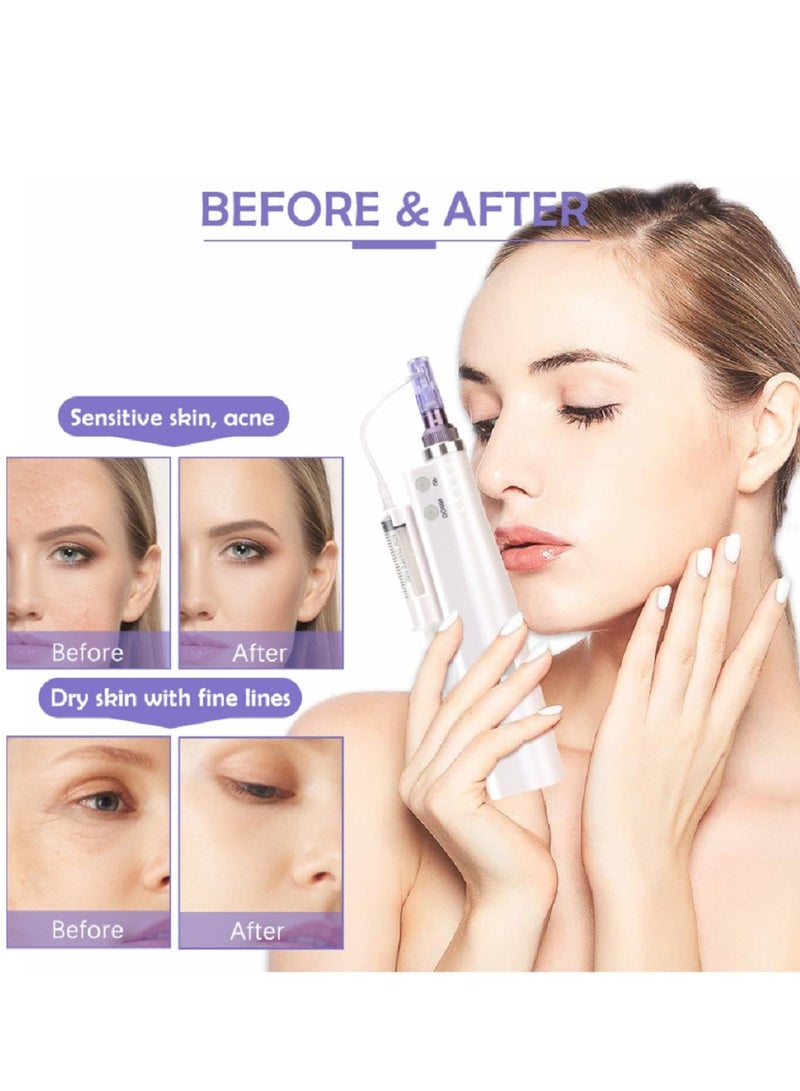 Portable Profesional MTS Microneedling Pen Skin Care Tool Hydra Pen F8 for Anti Wrinkle Machine - Image 3