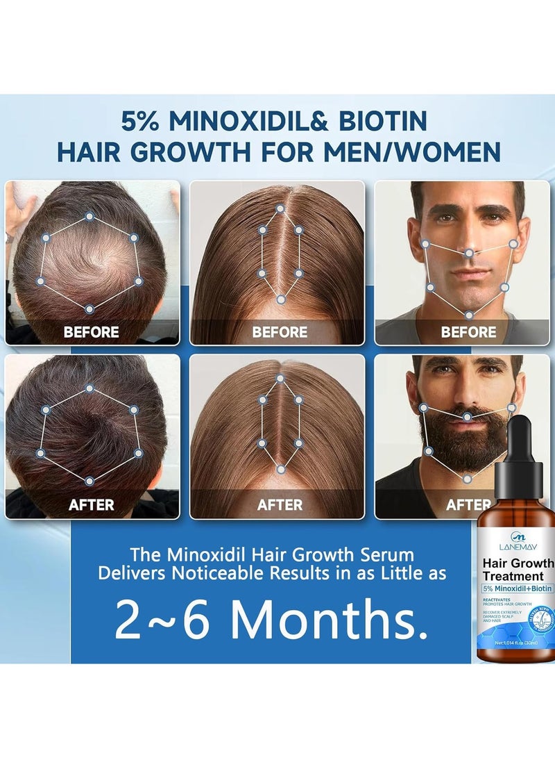 LANEMAY Minoxidil Hair Growth Serum, Advanced Hair Fall Control Serum with Minoxidil 5%, Biotin, Rosemary & Vitamin E, Anti-Hair Loss & Strengthening - Image 2