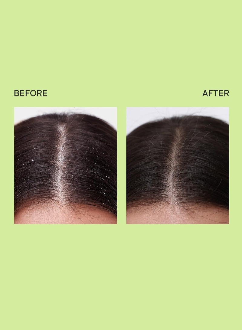 Quench Dandruff Control Hair Serum With Tea Tree Extracts | Treats Dandruff, Flakes & Greasy Scalp | Strengthens & Deeply Conditions | Made In Korea (100Ml) - Image 4