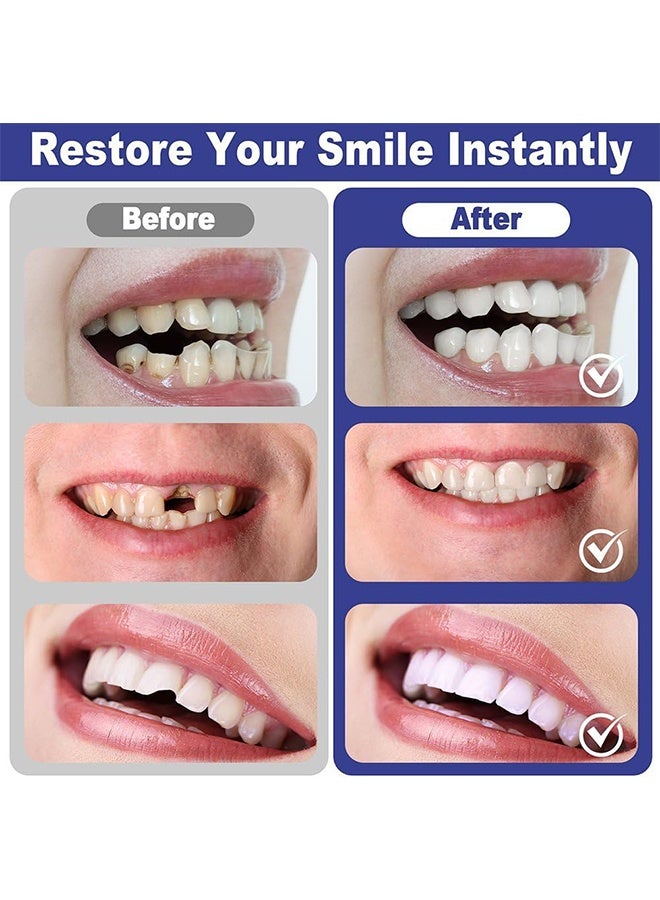 Feimuko Temporary Forming False Teeth Kit, Tooth Repair Kit, Moldable Tooth Filling Repair Kit With 4 Dental Tool, Tooth Replacement Missing Teeth, Dental Care Kit Fixing The Missing And Broken Replacements, DIY Natural Filling Fake Teeth, Smile Confidently Again - Image 2