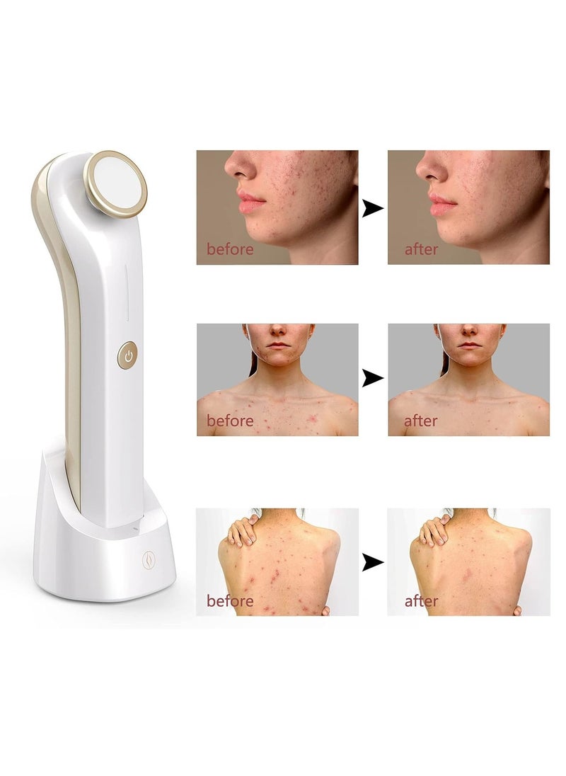 M MIAOYAN Portable Blue Light Acne Treatment Device, Wireless Rechargeable, Home Plasma Beauty Machine for Acne Removal, Scar Fading, Wrinkle Reduction, and Skin Tightening  - Image 5