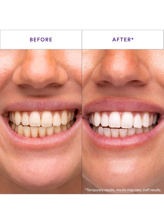 Hismile V34 Whitening Strips, Teeth Whitening Strips, Purple Tooth Whitening, Purple V34 Whitening Strips, Tooth Stain Treatment, Combining Whitening and Colour Correction - Image 4