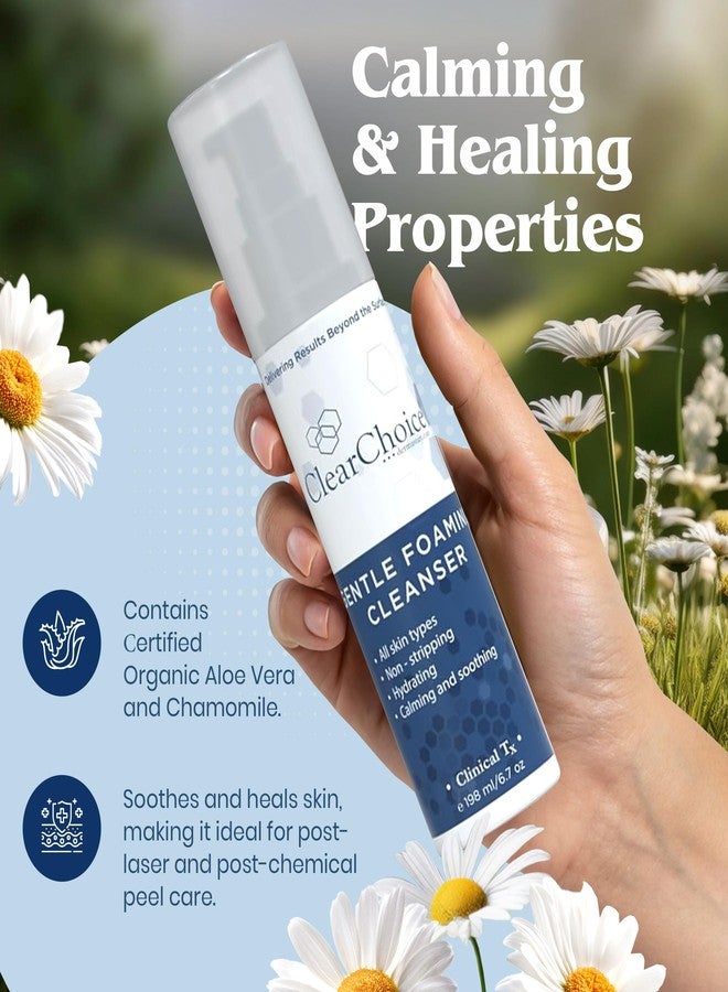 Clear Choice Gentle Foaming Cleanser 6.7oz - Soap-Free, SLS-Free Face Wash for Sensitive, Acne-Prone Skin - Restores pH Balance, Removes Makeup, Ideal for Post-Peel and Post-Laser Care - Image 2
