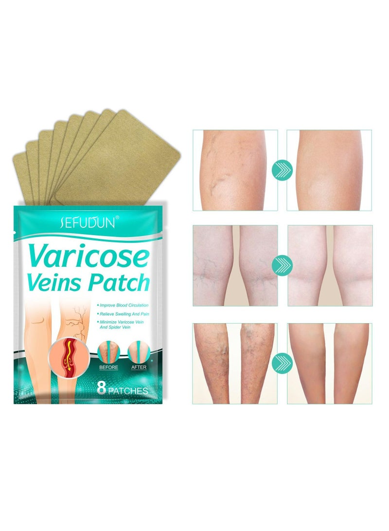 Sefudun 8 قطع من رقع الدوالي لتخفيف التهاب الوريد والتهاب الأوعية الدموية 100% مكونات طبيعية مضافة للقضاء على ظهور الدوالي وعلاج التهاب الوريد للرجال والنساء - Image 2