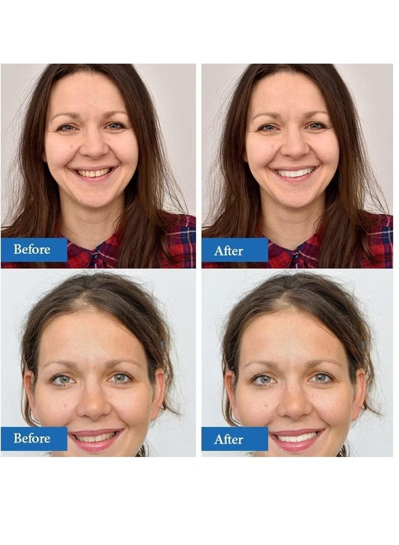 5 دي شرائط تبييض الاسنان 5D شرائط بيضاء 10 قطعه - Image 4