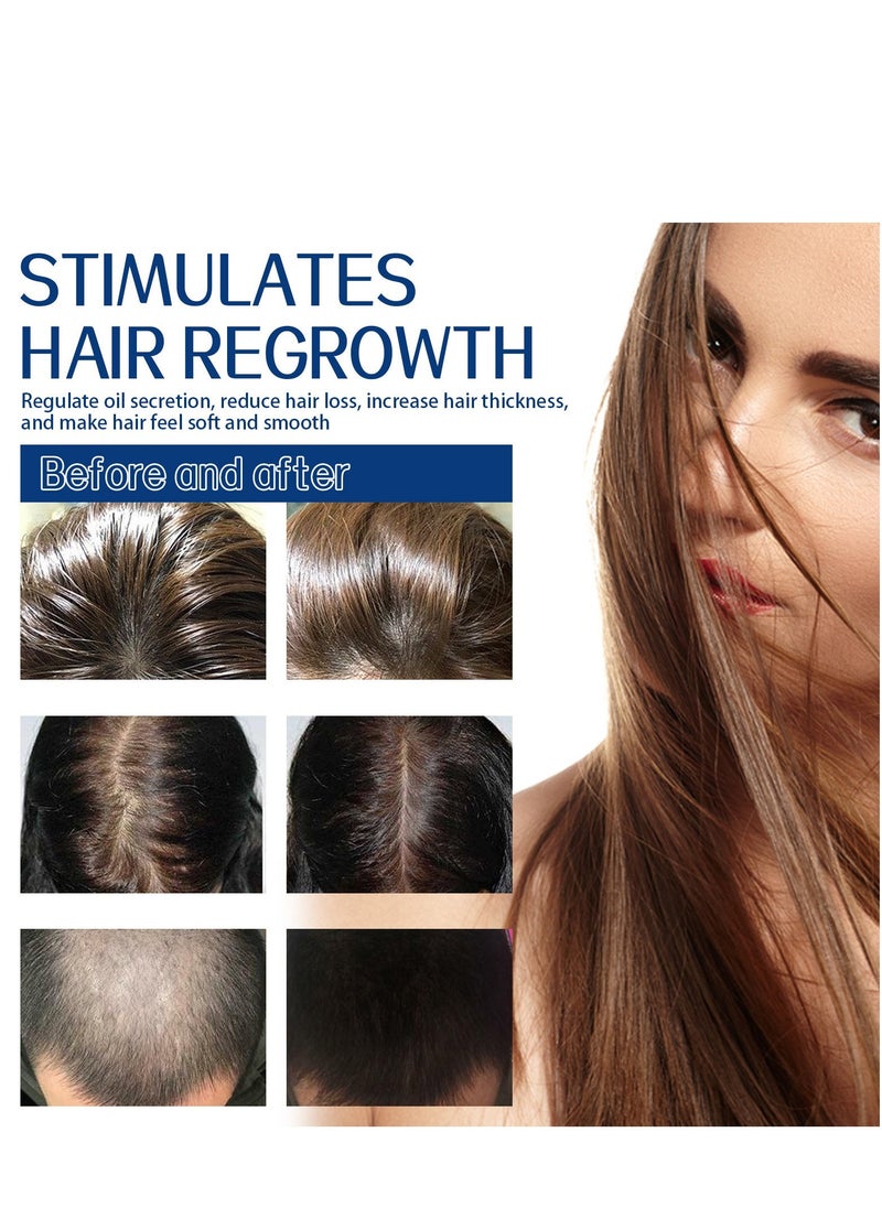 EELHOE مقشر فروة الرأس المقشر، علاج حكة القشرة، مقشر إزالة السموم للشعر، مقشر خالي من الكبريتات يهدئ فروة الرأس الجافة، المتقشرة، والحكة، يزيل التراكم - Image 5