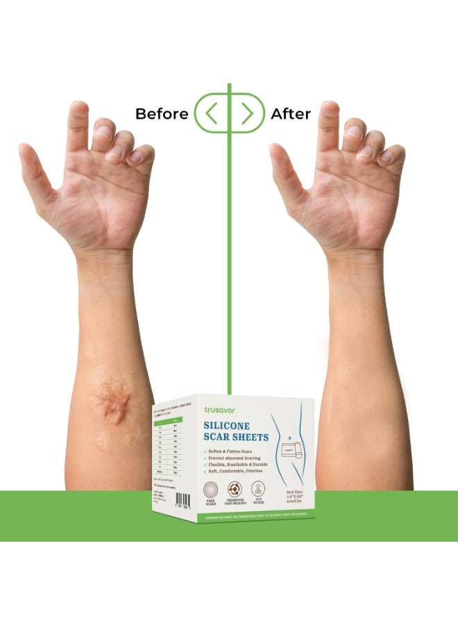 Trusavor Silicone Scar Sheets, (4cmX3m) Medical Grade, Flexible and Breathable, Scar Treatment Roll, Dermatologist Recommended - Image 3